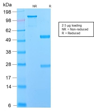SDS-PAGE Analysis Purified NGFR Rabbit Recombinant Monoclonal Antibody (NGFR/2550R). Confirmation of Purity and Integrity of Antibody.