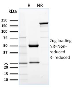 SDS-PAGE Analysis Purified AKT1 Mouse Monoclonal Antibody (AKT1/2552). Confirmation of Purity and Integrity of Antibody.