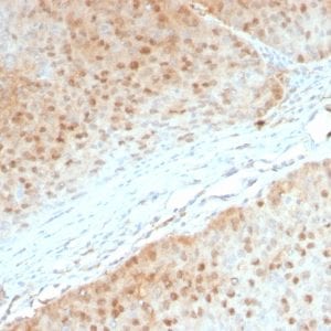 Formalin-fixed paraffin-embedded human Pancreas stained with AKT1 Mouse Monoclonal Antibody (AKT1/2552).