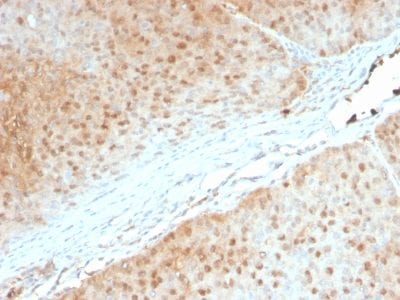 Formalin-fixed paraffin-embedded human Pancreas stained with AKT1 Mouse Monoclonal Antibody (AKT1/2552).