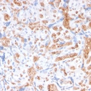 Formalin-fixed paraffin-embedded Human Placenta stained with Spectrin alpha 1 Mouse Recombinant Monoclonal Antibody (rSPTA1/1833).