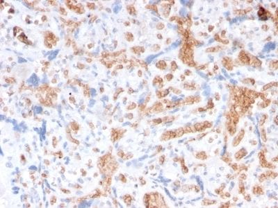 Formalin-fixed paraffin-embedded Human Placenta stained with Spectrin alpha 1 Mouse Recombinant Monoclonal Antibody (rSPTA1/1833).