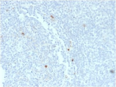 Formalin-fixed paraffin-embedded human Tonsil stained with IgM Mouse Recombinant Monoclonal Antibody (rIM373).