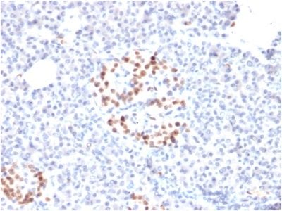 Formalin-fixed paraffin-embedded human Pancreas stained with NKX6.1 Mouse Monoclonal Antibody (NKX61/2561).