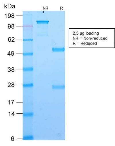 SDS-PAGE Analysis Purified DOG-1 Rabbit Recombinant Monoclonal Antibody (DG1/2564R). Confirmation of Purity and Integrity of Antibody.