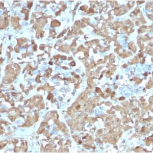 Formalin-fixed paraffin-embedded Human Pituitary stained with Growth Hormone Recombinant Mouse Monoclonal Antibody (rGH/1450).