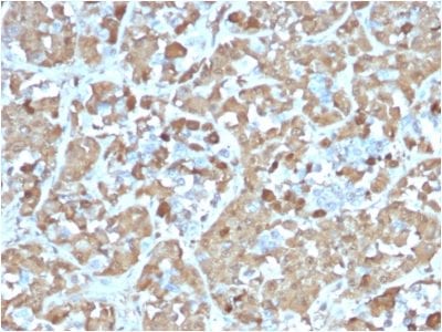 Formalin-fixed paraffin-embedded Human Pituitary stained with Growth Hormone Recombinant Mouse Monoclonal Antibody (rGH/1450).