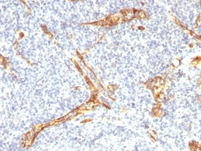 Formalin-fixed paraffin-embedded human Tonsil stained with CD34 Recombinant Rabbit Monoclonal Antibody (HPCA1/2598R).