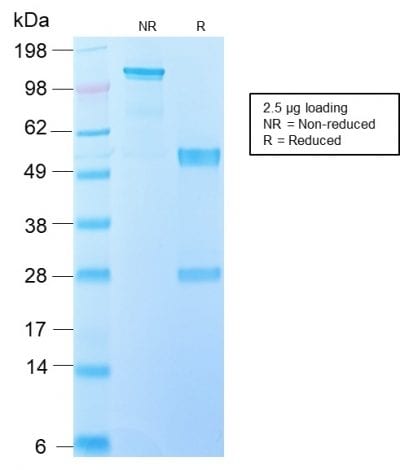 SDS-PAGE Analysis Purified EGFRvIII Rabbit Recombinant Monoclonal Antibody (GFR/2600R). Confirmation of Purity and Integrity of Antibody.