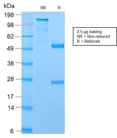 SDS-PAGE Analysis Purified MUC1 Recombinant Rabbit Monoclonal Antibody (MUC1/2729R). Confirmation of Purity and Integrity of Antibody.