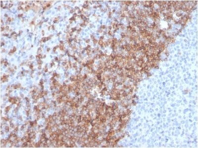 Formalin-fixed paraffin-embedded human Tonsil stained with IgD Recombinant Rabbit Monoclonal Antibody (IGHD/2730R).
