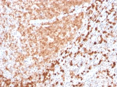 Formalin-fixed paraffin-embedded human Tonsil stained with TCL1 Recombinant Rabbit Monoclonal Antibody (TCL1/2747R).