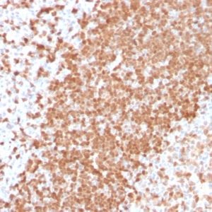 Formalin-fixed paraffin-embedded human Tonsil stained with TCL1 Recombinant Rabbit Monoclonal Antibody (TCL1/2747R).