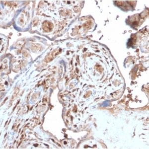 Formalin-fixed paraffin-embedded human Placenta stained with S100A4 Recombinant Rabbit Monoclonal Antibody (S100A4/2750R).