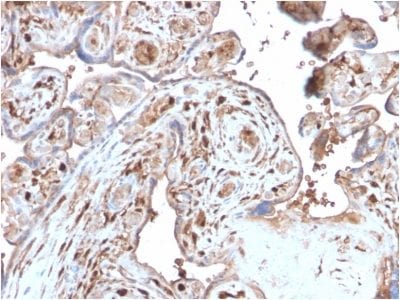 Formalin-fixed paraffin-embedded human Placenta stained with S100A4 Recombinant Rabbit Monoclonal Antibody (S100A4/2750R).