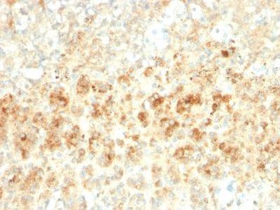 Formalin-fixed paraffin-embedded human Adrenal Gland stained with Adipophilin Recombinant Rabbit Monoclonal Antibody (ADFP/2755R).