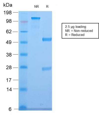 SDS-PAGE Analysis of Purified CELA3B Rabbit Recombinant Monoclonal Antibody (CELA3B/2810R). Confirmation of Purity and Integrity of Antibody.