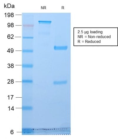 SDS-PAGE Analysis Purified Golgi Rabbit Recombinant Monoclonal Antibody (GLG1/2829R). Confirmation of Purity and Integrity of Antibody.