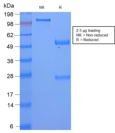 SDS-PAGE Analysis Serum Amyloid A Rabbit Recombinant Monoclonal Antibody (SAA/2868R). Confirmation of Purity and Integrity of Antibody