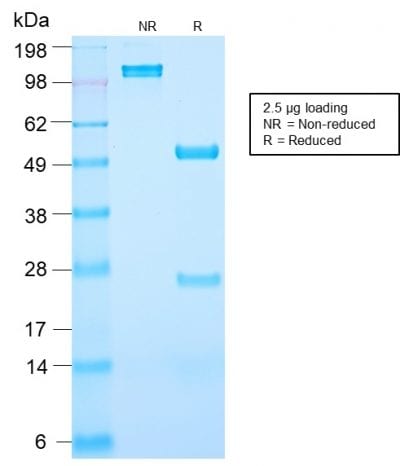 SDS-PAGE Analysis Purified PSA Rabbit Recombinant Monoclonal Antibody (KLK3/2871R). Confirmation of Purity and Integrity of Antibody.