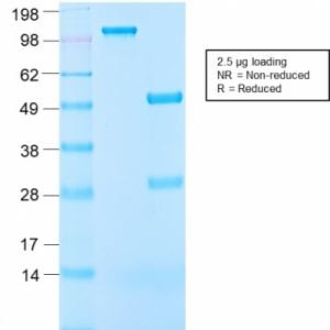 SDS-PAGE Analysis Purified IGF-1 Rabbit Recombinant Monoclonal Anitbody (IGF1/2872R). Confirmation of Purity and Integrity of Antibody.