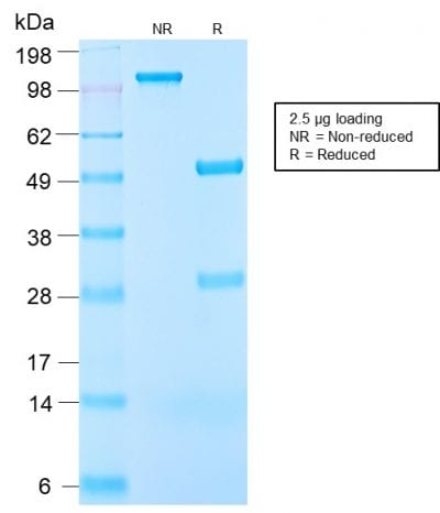 SDS-PAGE Analysis Purified IGF-1 Rabbit Recombinant Monoclonal Anitbody (IGF1/2872R). Confirmation of Purity and Integrity of Antibody.