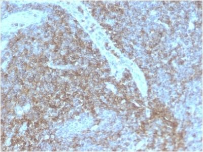 Formalin-fixed paraffin-embedded human Lymph Node stained with CD44 Rabbit Recombinant Monoclonal Antibody (HCAM/2875R).
