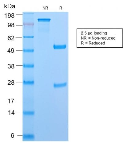 SDS-PAGE Analysis Purified CD45RB Rabbit Recombinant Monoclonal Antibody (PTPRC/2877R). Confirmation of Purity and Integrity of Antibody.