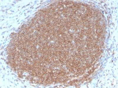 Formalin-fixed paraffin-embedded human Lymph Node stained with CD45RB Rabbit Recombinant Monoclonal Antibody (PTPRC/2877R).