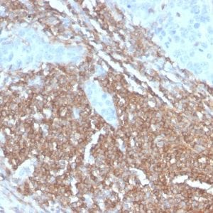 Formalin-fixed paraffin-embedded human Lymph Node stained with CD45RB Rabbit Recombinant Monoclonal Antibody (PTPRC/2877R).