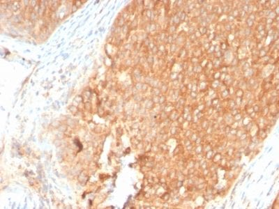 Formalin-fixed paraffin-embedded human Pancreas stained with Topo I Rabbit Recombinant Monoclonal Antibody (TOP1MT/2883R).