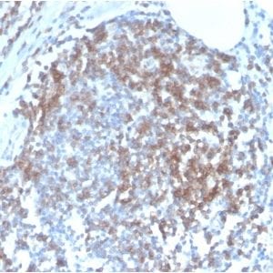 Formalin-fixed paraffin-embedded human Tonsil stained with CD6 Rabbit Recombinant Monoclonal Antibody (C6/2884R).
