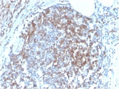 Formalin-fixed paraffin-embedded human Tonsil stained with CD6 Rabbit Recombinant Monoclonal Antibody (C6/2884R).