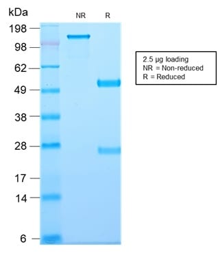 SDS-PAGE Analysis Purified CD81 Rabbit Recombinant Monoclonal Antibody (C81/2885R). Confirmation of Purity and Integrity of Antibody.