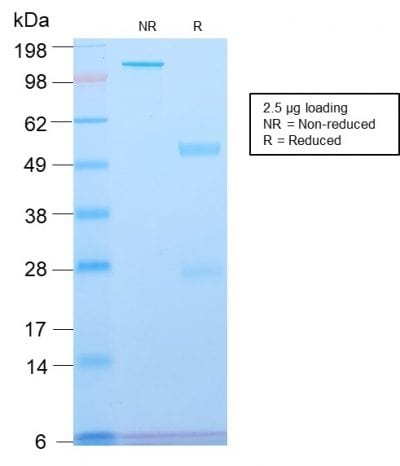 SDS-PAGE Analysis Purified Spectrin beta III Rabbit Recombinant Monoclonal (SPTBN2/2894R). Confirmation of Purity and Integrity of Antibody.