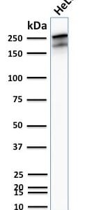Western Blot Analysis of HeLa Cell Lysates using Spectrin beta III Rabbit Recombinant Monoclonal (SPTBN2/2894R).