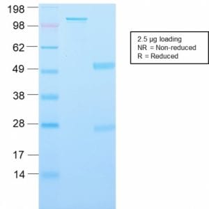 SDS-PAGE Analysis Major Vault Protein Rabbit Recombinant Monoclonal Antibody (VP2897R). Confirmation of Purity and Integrity of Antibody.