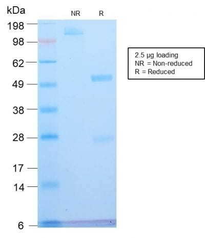 SDS-PAGE Analysis Purified ATRX Rabbit Recombinant Monoclonal Antibody (ATRX/2900R). Confirmation of Purity and Integrity of Antibody.