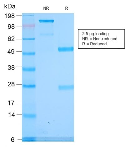 SDS-PAGE Analysis Purified Spectrin alpha 1 Rabbit Recombinant Monoclonal (SPTA1/2939R). Confirmation of Purity and Integrity of Antibody.