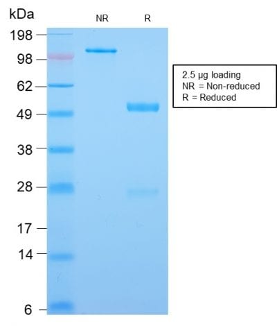SDS-PAGE Analysis Purified CDX2 Rabbit Recombinant Monoclonal Antibody (CDX2/2951R). Confirmation of Purity and Integrity of Antibody.