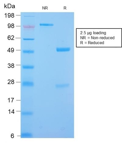 SDS-PAGE Analysis Purified Desmin Rabbit Recombinant Monoclonal Antibody (DES/2960R). Confirmation of Purity and Integrity of Antibody.