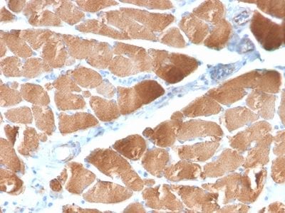 Formalin-fixed paraffin-embedded human Skeletal Muscle stained with Desmin Rabbit Recombinant Monoclonal Antibody (DES/2960R).