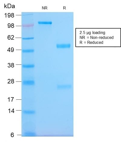 SDS-PAGE Analysis Purified HLA-DP Rabbit Recombinant Monoclonal Ab (HLA-DPQR/2967R). Confirmation of Purity and Integrity of Antibody.