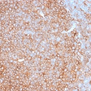 Formalin-fixed paraffin-embedded human Tonsil stained with HLA-DP/-DQ/-DR Rabbit Recombinant Monoclonal Ab (HLA-DPQR/2967R).