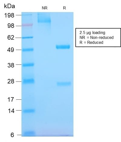 SDS-PAGE Analysis Purified EGFR Rabbit Recombinant Monoclonal Antibody (GFR/2968R). Confirmation of Purity and Integrity of Antibody.