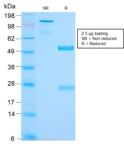SDS-PAGE Analysis Purified MUC2 Rabbit Recombinant Monoclonal Antibody (MLP/2970R). Confirmation of Purity and Integrity of Antibody.