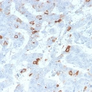 Formalin-fixed paraffin-embedded human Colon stained with MUC2 Rabbit Recombinant Monoclonal Antibody (MLP/2970R).