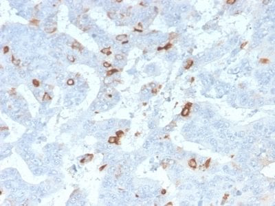 Formalin-fixed paraffin-embedded human Colon stained with MUC2 Rabbit Recombinant Monoclonal Antibody (MLP/2970R).