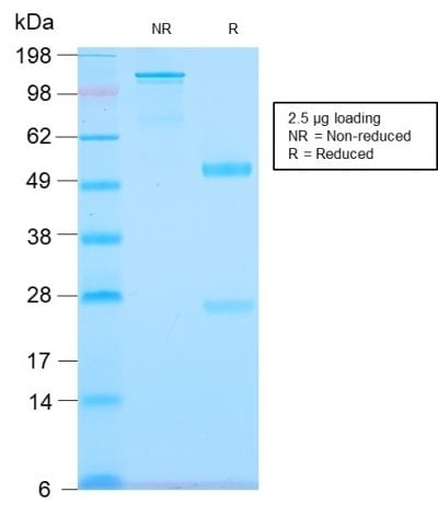 SDS-PAGE Analysis Purified Tenascin C Rabbit Recombinant Monoclonal Antibody (TNC/2981R). Confirmation of Purity and Integrity of Antibody.