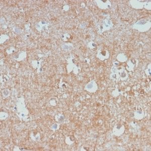 Formalin-fixed paraffin-embedded human Cerebellum stained with Neurofilament Rabbit Monoclonal Antibody (NEFL/2983R).